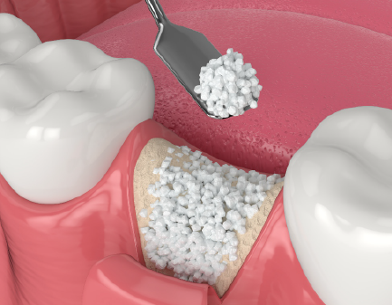 Digital Smile Design